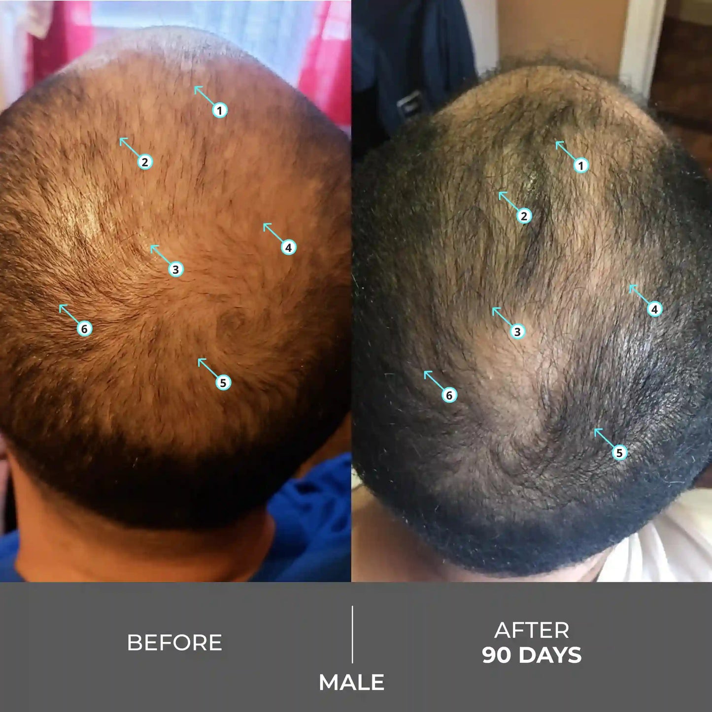 Advanced Hair Density Shampoo